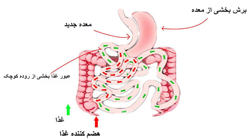 ساسی بای پس
