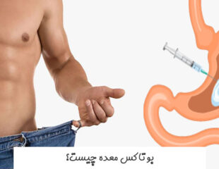 بوتاکس معده