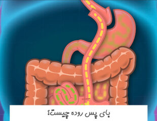 بای پس روده