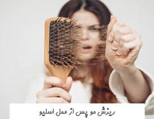 ریزش مو پس از عمل اسلیو