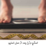 استپ وزن بعد از عمل اسلیو معده