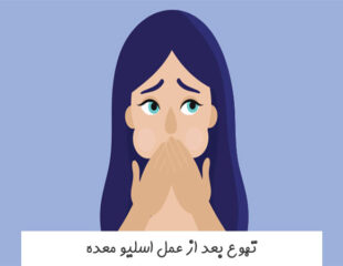 تهوع بعد از عمل اسلیو معده